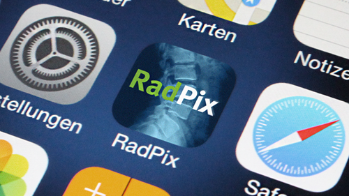 RADPIX: App Design & -Entwicklung für iPhone, iPad & Android